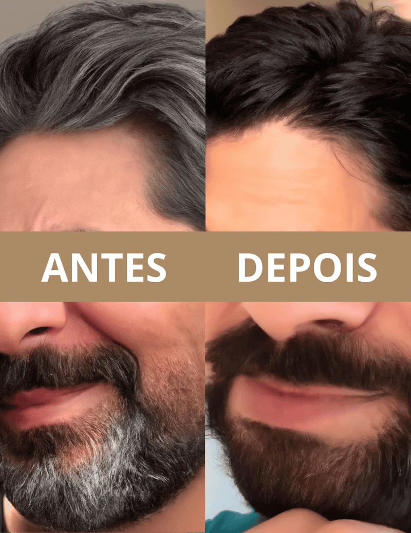 Mane Hair™ Shampoo Anti-Grisalho - Amelos