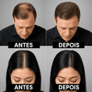 Pó Em Fibra De Queratina - Anti-Calvície - HairFiber Sevích™