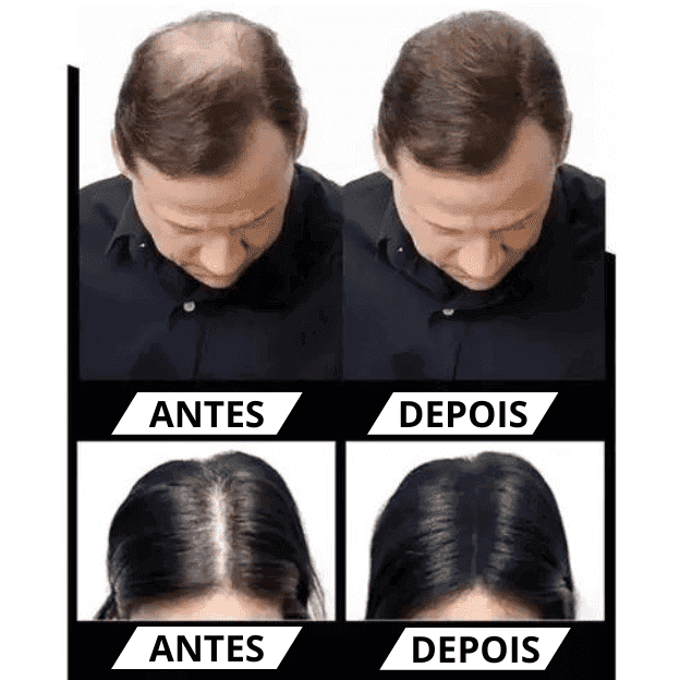 Pó Em Fibra De Queratina - Anti-Calvície - HairFiber Sevích™ - Amelos