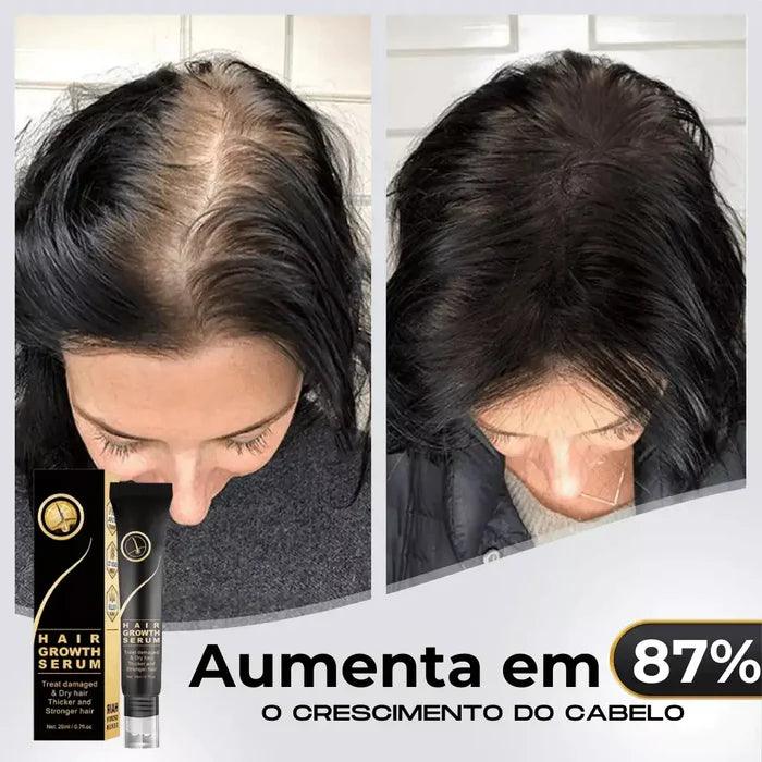 Repair Hair™ - Tratamento Antiqueda + Crescimento Capilar em 90% - Amelos