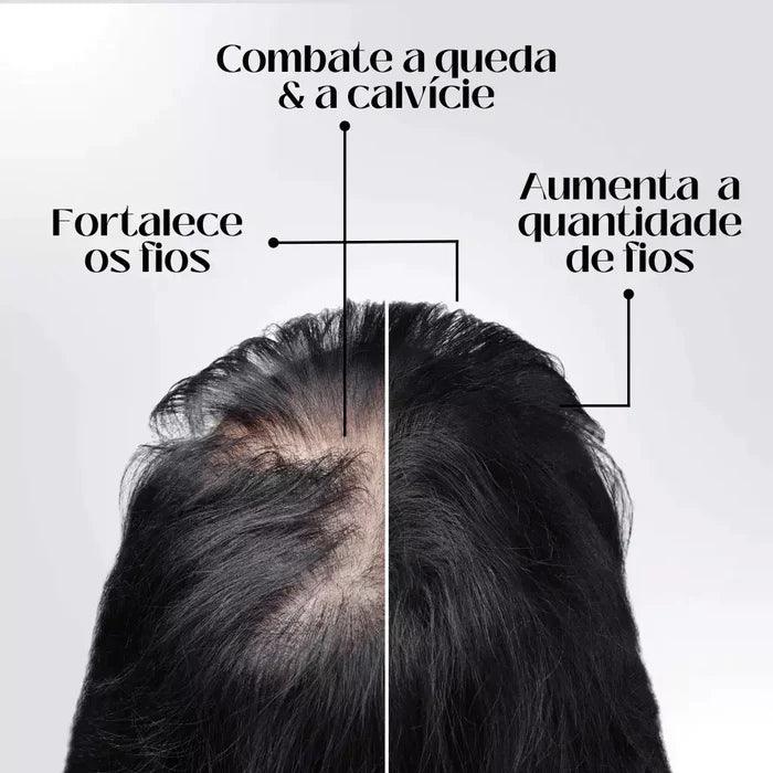 Repair Hair™ - Tratamento Antiqueda + Crescimento Capilar em 90% - Amelos