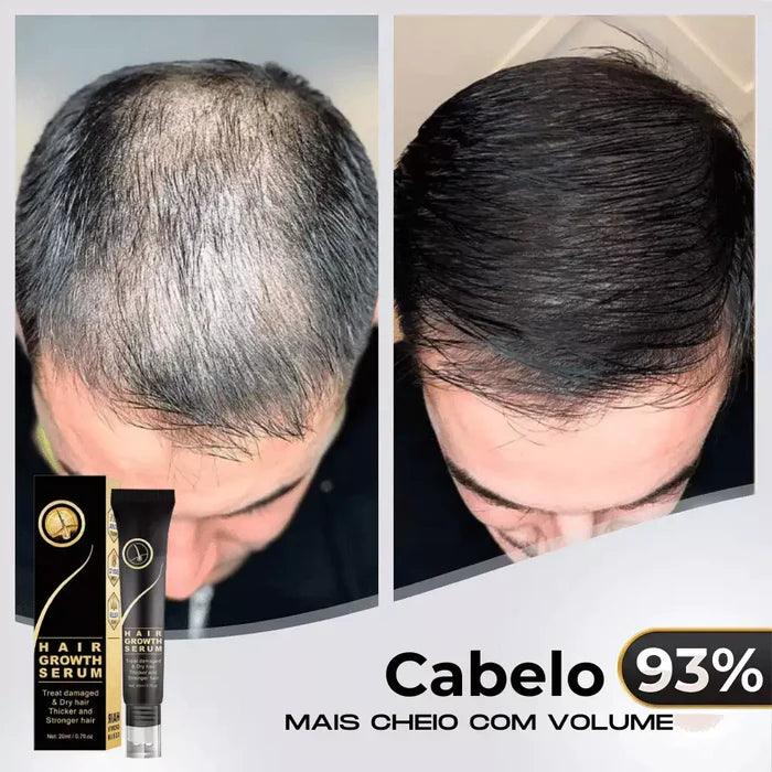 Repair Hair™ - Tratamento Antiqueda + Crescimento Capilar em 90% - Amelos