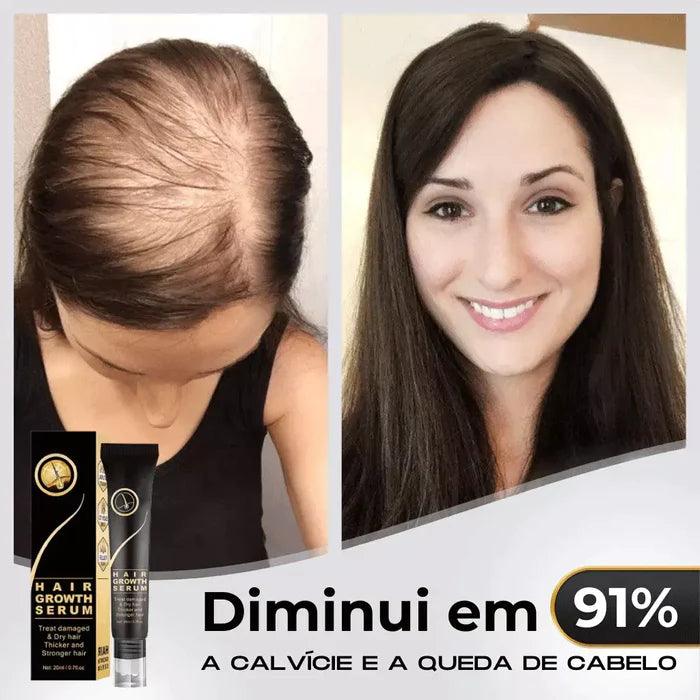 Repair Hair™ - Tratamento Antiqueda + Crescimento Capilar em 90% - Amelos