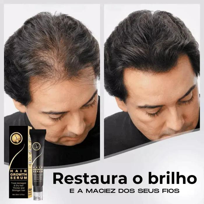 Repair Hair™ - Tratamento Antiqueda + Crescimento Capilar em 90% - Amelos