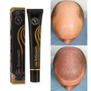 Repair Hair™ - Tratamento Antiqueda + Crescimento Capilar em 90% - Amelos